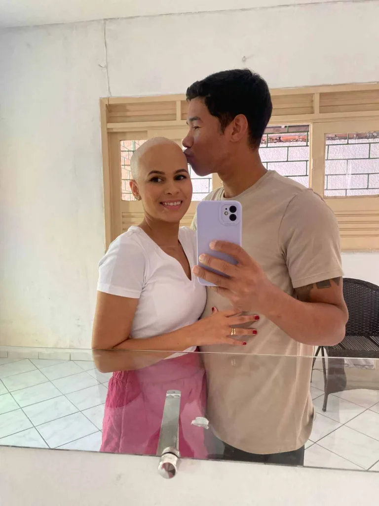 Diagnosticada com câncer de mama aos 28 anos, Fernanda valoriza a vida: "estar careca era só um detalhe"