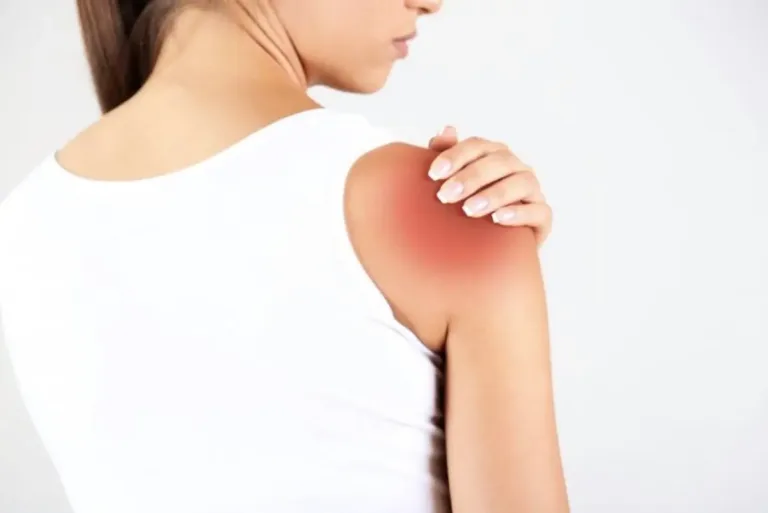 artrose acromioclavicular