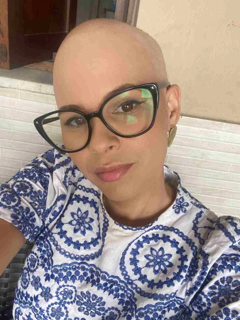 Diagnosticada com câncer de mama aos 28 anos, Fernanda valoriza a vida: "estar careca era só um detalhe"
