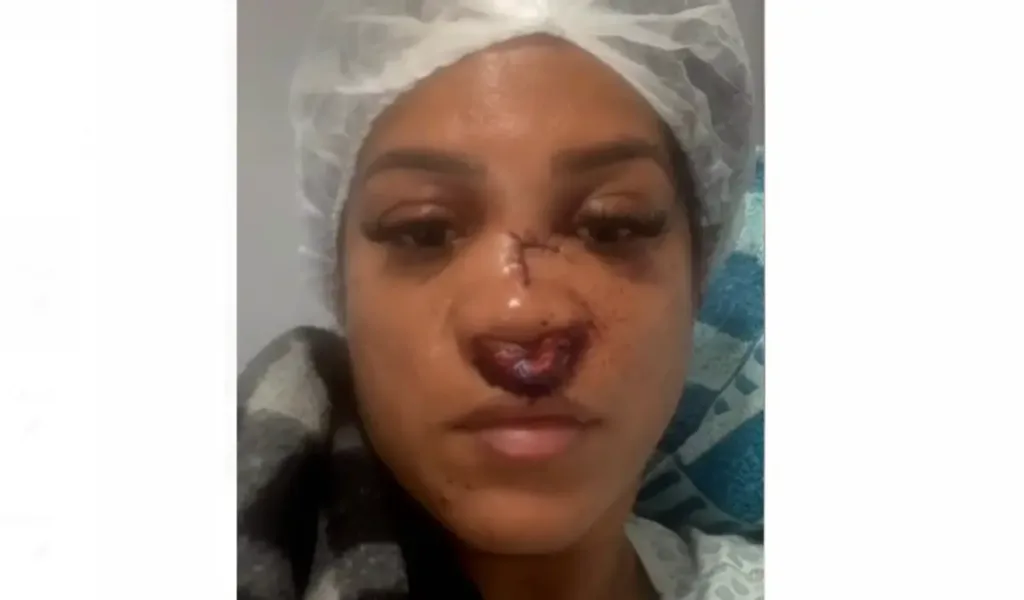 presidente de associação do Viveiros é acusado de agredir comerciante