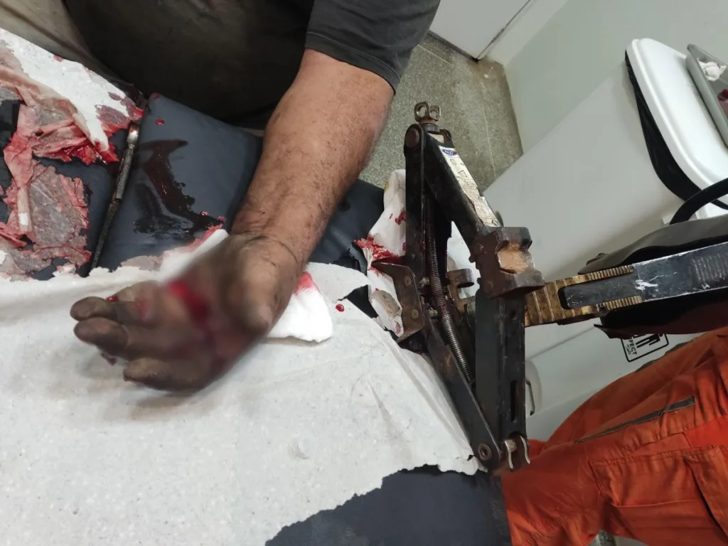 Homem com mão presa em macaco mecânico é socorrido por bombeiros