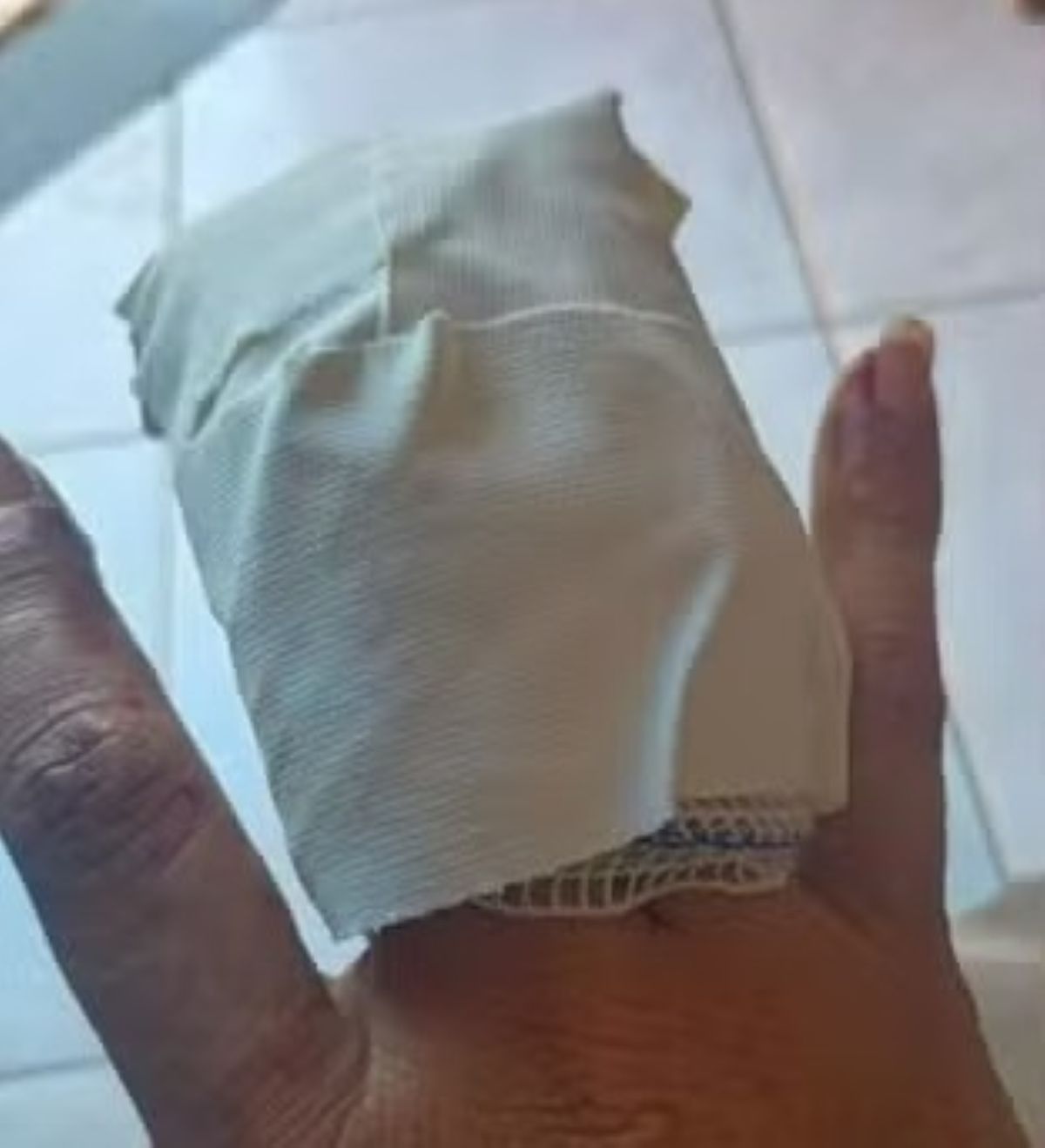 Motorista por aplicativo perde parte de dedo da mão após ter bomba de São João jogada dentro do carro