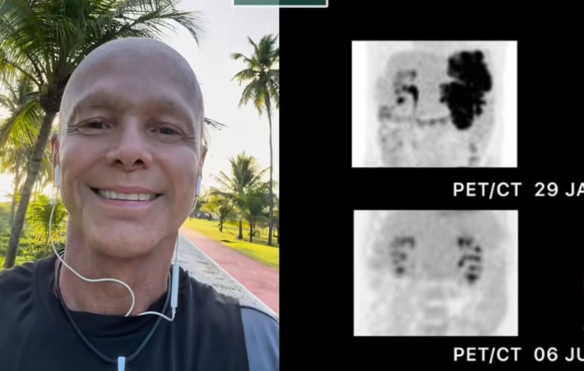 Após se declarar livre do câncer, Netinho realiza penúltima sessão de quimioterapia