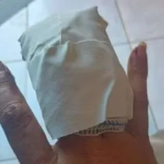 Motorista por aplicativo perde parte de dedo da mão após ter bomba de São João jogada dentro do carro