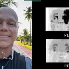 Após se declarar livre do câncer, Netinho realiza penúltima sessão de quimioterapia