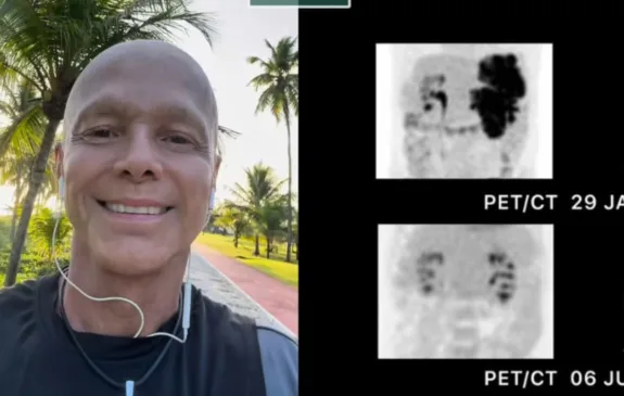 Após se declarar livre do câncer, Netinho realiza penúltima sessão de quimioterapia