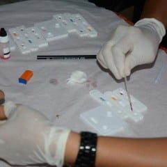 Casos de HIV