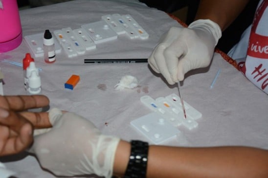 Casos de HIV