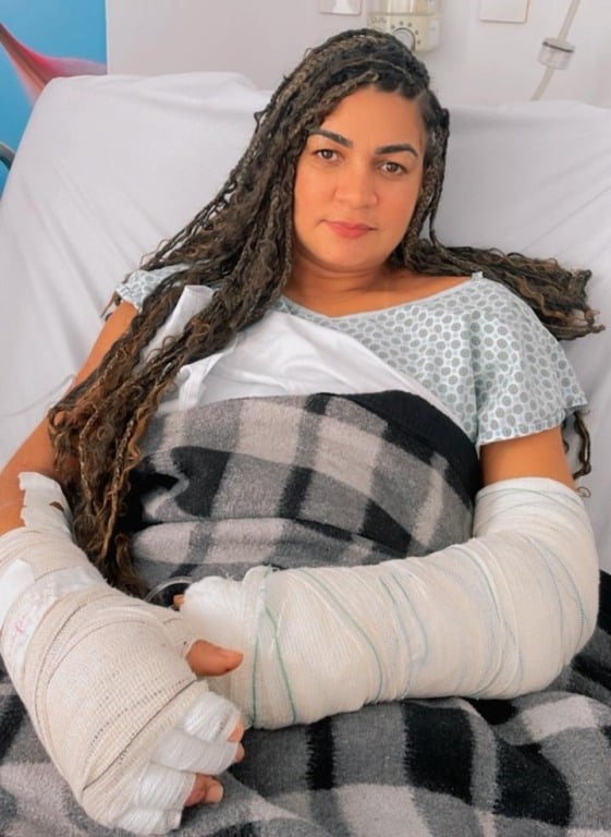 Rafaela - empresária - queimaduras - Foto - Arquivo Pesoal