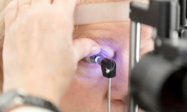 Glaucoma