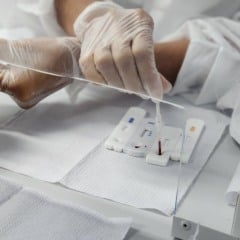 Sesab desmente boato de surto de HIV entre jovens na Bahia