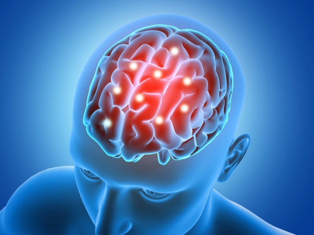 Sequelas cerebrais pós Covid-19; medicina integrativa atua na tratamento dos danos