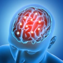 Sequelas cerebrais pós Covid-19; medicina integrativa atua na tratamento dos danos