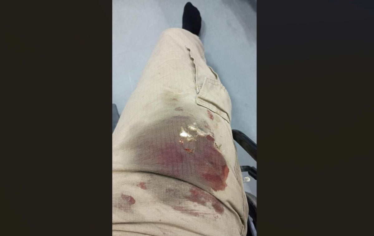Policial Militar baleado