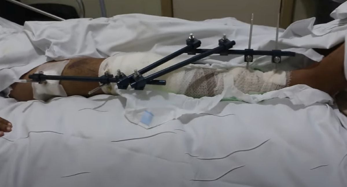 Vítima de acidente de moto