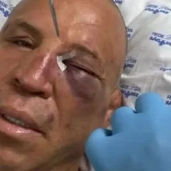 Wanderlei após a luta com Popó