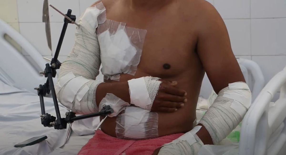 Vítima de acidente de moto