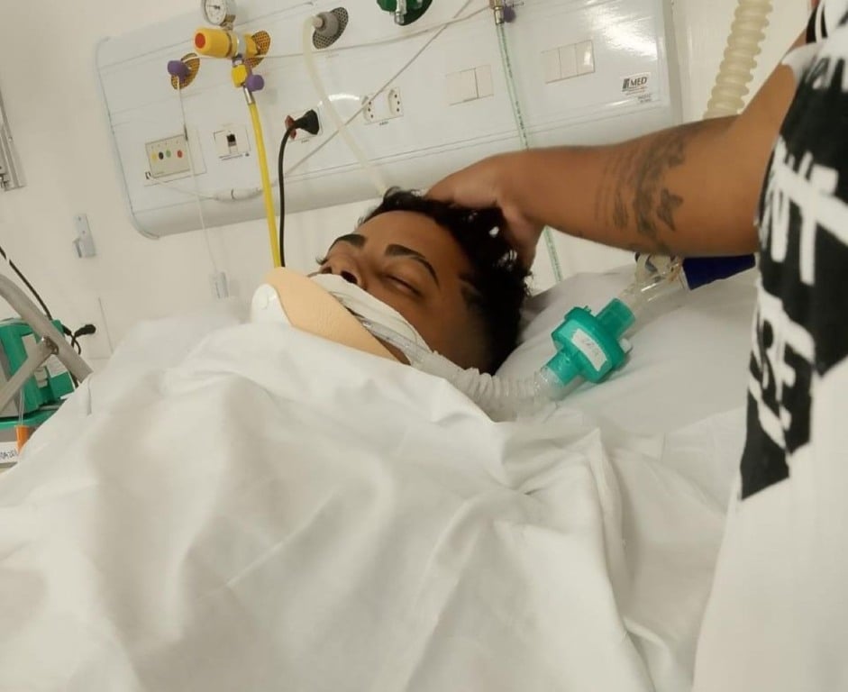 Motoboy que perdeu a perna em acidente luta por prótese para recuperar independência e sustentar a família