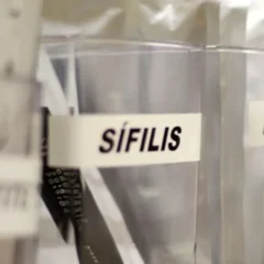 sífilis