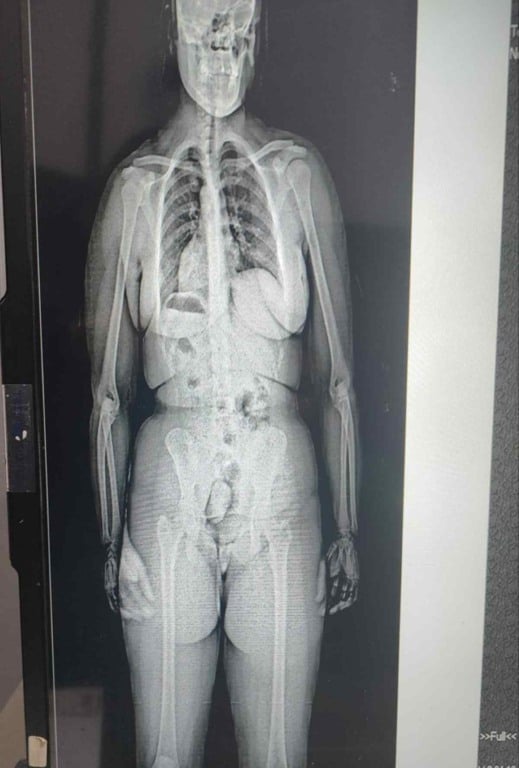 Mulheres s&atilde;o detidas ao tentar entrar com drogas no Conjunto Penal de Eun&aacute;polis