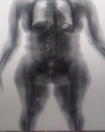 BodyScan