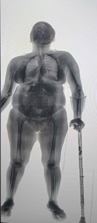 Idosa é flagrada tentando entrar com drogas e eletrônicos escondidos em muleta e chinelo na Cadeia Pública de Salvador | Foto: Seap