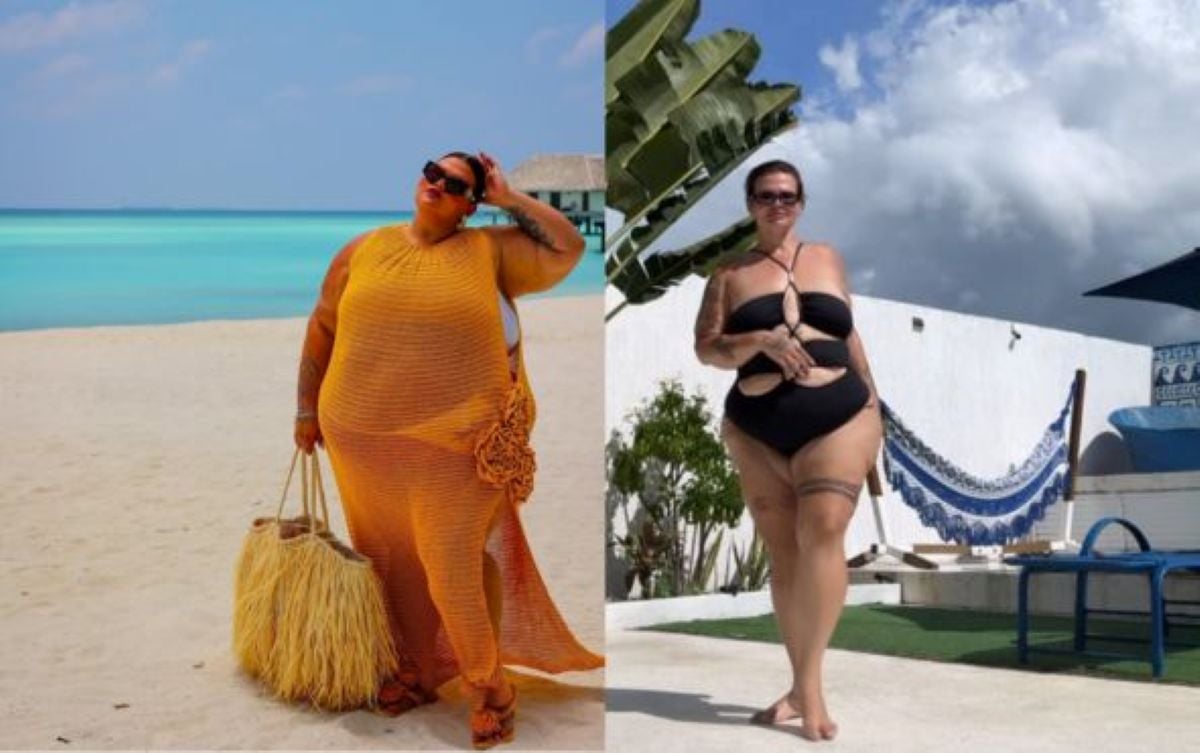 Thais Carla antes e depois da cirurgia bariátrica