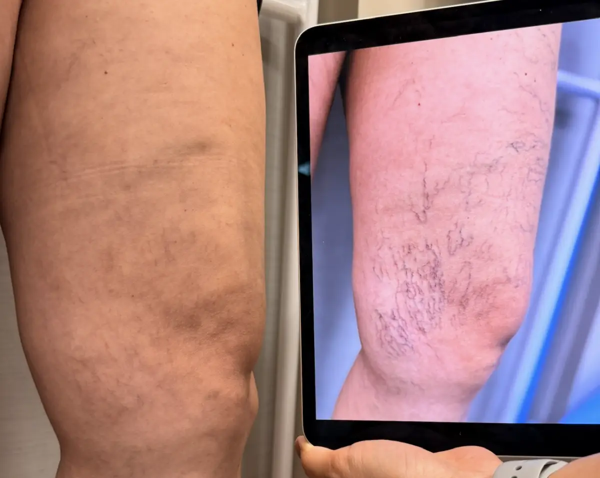 Pernas cansadas não são normais e podem não ter nada a ver com cansaço