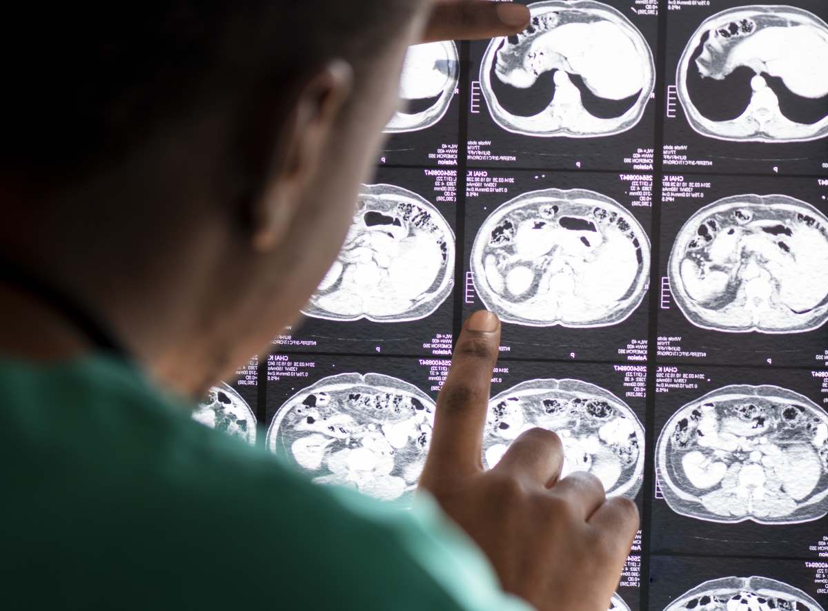 Doutor vendo exames cerebrais