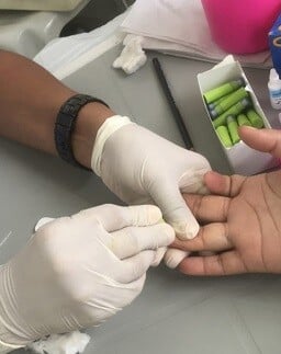 HIV Aids