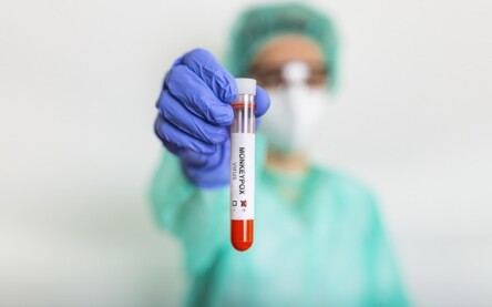 Monkeypox virus test. It is also known as the Moneypox virus, is a double-stranded DNA, zoonotic virus and a species of the genus Orthopoxvirus in the family Poxviridae