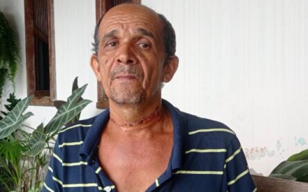 Motociclista é atingido no pescoço por fio de telefonia solto em via pública e socorrido para a Upa (Foto: Ed Santos/Acorda Cidade)