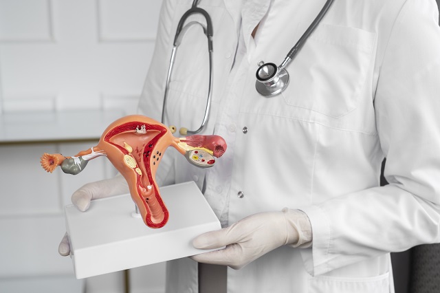 Cólica não é normal: ginecologista lança campanha de conscientização sobre endometriose