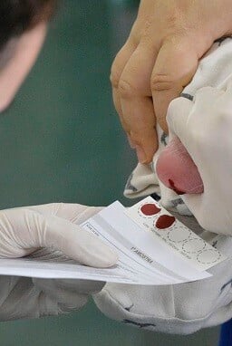 BIE - Teste do pezinho no Hospital Regional de Taguatinga (HRT). O teste do pezinho, exame feito a partir de sangue coletado do calcanhar do bebê, é uma das principais formas de diagnosticar seis doenças que, quanto mais cedo forem identificadas, melhores são as chances de tratamento. São elas fenilcetonúria, hipotireoidismo congênito, doença falciforme e outras hemoglobinopatias, fibrose cística, deficiência de biotinidase e hiperplasia adrenal congênita. Para realizar o teste do pezinho, a família deve levar o recém-nascido a uma unidade básica de saúde entre o 3° e o 5° dia de vida. É fundamental ter atenção a esse prazo. Foto: Edilson Rodrigues/Agência Senado
