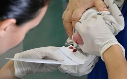 BIE - Teste do pezinho no Hospital Regional de Taguatinga (HRT). O teste do pezinho, exame feito a partir de sangue coletado do calcanhar do bebê, é uma das principais formas de diagnosticar seis doenças que, quanto mais cedo forem identificadas, melhores são as chances de tratamento. São elas fenilcetonúria, hipotireoidismo congênito, doença falciforme e outras hemoglobinopatias, fibrose cística, deficiência de biotinidase e hiperplasia adrenal congênita. Para realizar o teste do pezinho, a família deve levar o recém-nascido a uma unidade básica de saúde entre o 3° e o 5° dia de vida. É fundamental ter atenção a esse prazo. Foto: Edilson Rodrigues/Agência Senado