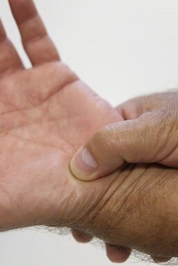 Fibromialgia