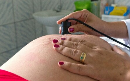 Foto: MDS