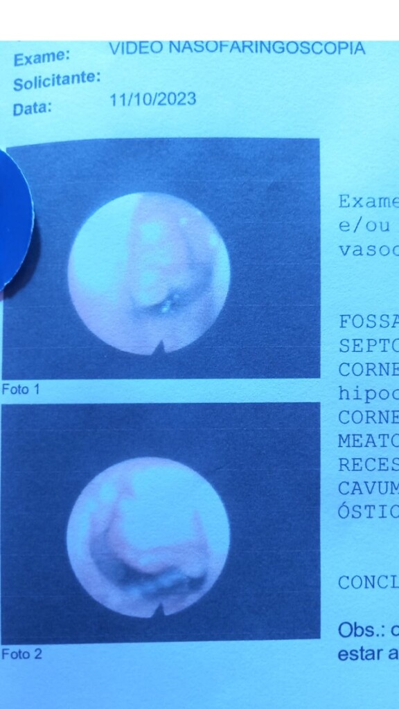 vaquinha para cirurgia de Kauê barreto4