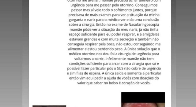 vaquinha para cirurgia de Kauê barreto4