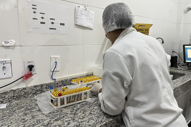 Exame de PSA no laboratório do Hospital da Mulher ft Victória Seixas3