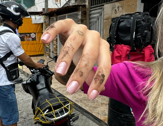 Médica sofre acidente de moto no bairro São João após derrapar em óleo descartado na rua3